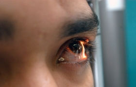 Alerta IMSS sobre s&iacute;ndrome ocular 
